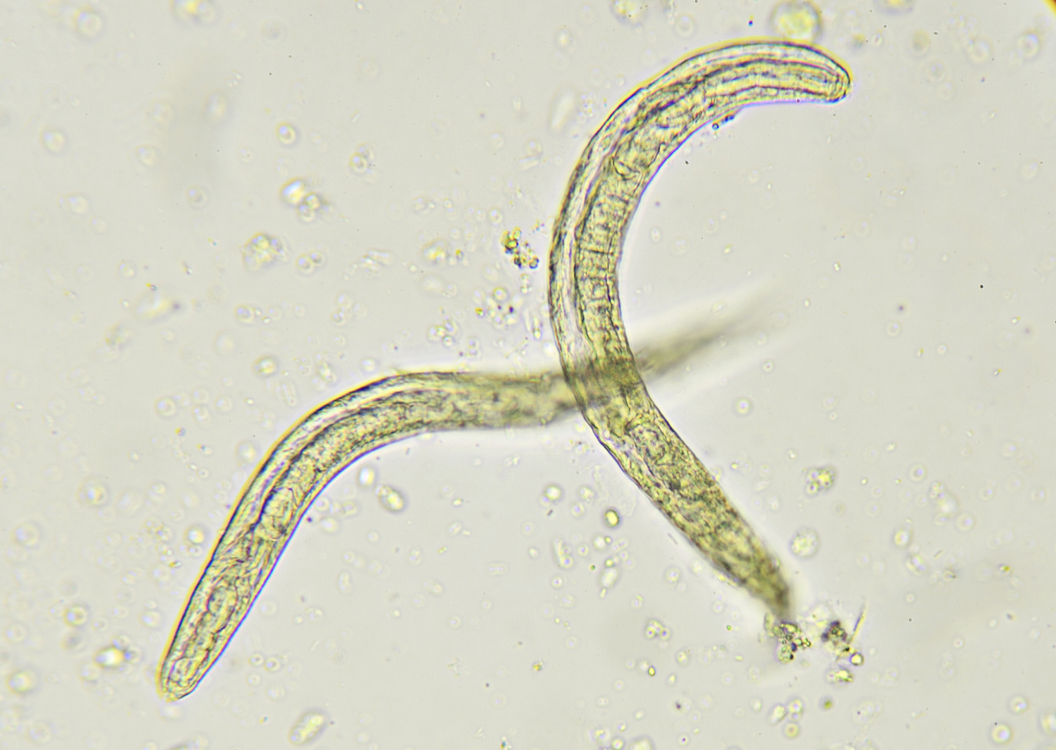 Strongiloidiasis